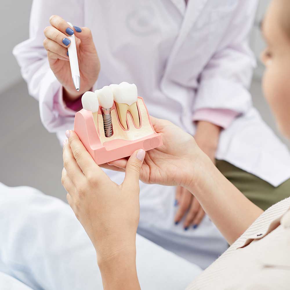 Dentist Presenting a Dental Implant Modal