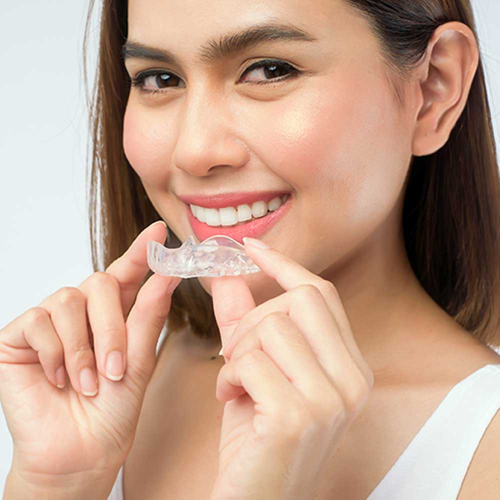 New orthodontic method, using Invisalign